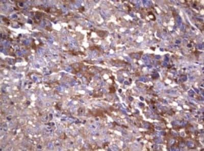 Immunohistochemistry: Wnt3 Antibody (OTI1G7) [NBP2-46367]