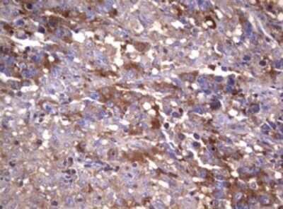 Immunohistochemistry: Wnt3 Antibody (OTI1G7) - Azide and BSA Free [NBP2-74869]