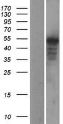 Western Blot: Wnt-5a Overexpression Lysate [NBL1-17872]