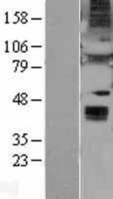 Western Blot: Wnt-6 Overexpression Lysate [NBL1-17875]