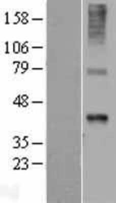 Western Blot: Wnt-7b Overexpression Lysate [NBL1-17877]