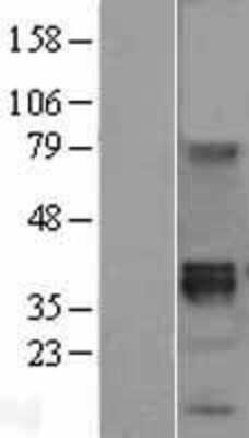 Western Blot: Wnt-8b Overexpression Lysate [NBL1-17879]