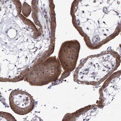 Immunohistochemistry: XAB1 Antibody [NBP2-38332]