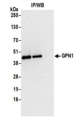 Immunoprecipitation: XAB1 Antibody [NBP2-37686]