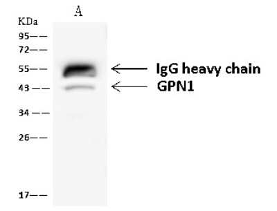Immunoprecipitation: XAB1 Antibody [NBP2-97600]