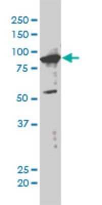 Western Blot: XAB2 Antibody (1D1-1A9) [H00056949-M01]