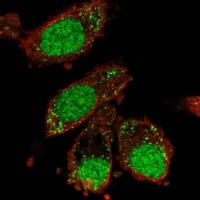 Immunocytochemistry/ Immunofluorescence: XAB2 Antibody [NBP2-58367]