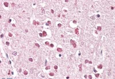 Immunohistochemistry-Paraffin: XAB2 Antibody [NB100-794]
