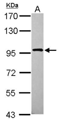 Western Blot: XAB2 Antibody [NBP2-20916]