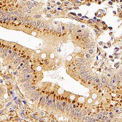 Immunohistochemistry-Paraffin: XAF1 Antibody [NB100-56355]