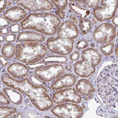 Immunohistochemistry-Paraffin: XAF1 Antibody [NBP2-49253]