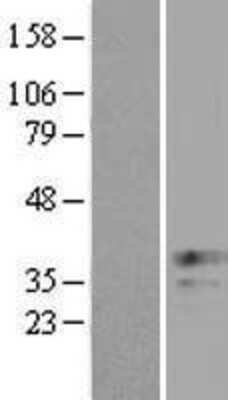 Western Blot: XAF1 Overexpression Lysate [NBL1-17897]