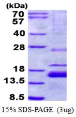 SDS-PAGE: Recombinant Human XAGE1 His Protein [NBP2-22950]