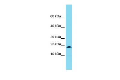 Western Blot: XAGE1A Antibody [NBP3-09697]