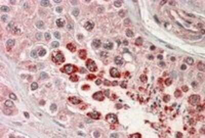 Immunohistochemistry-Paraffin: XAGE1D Antibody [NB300-997]