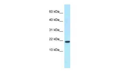 Western Blot: XAGE1D Antibody [NBP2-86898]