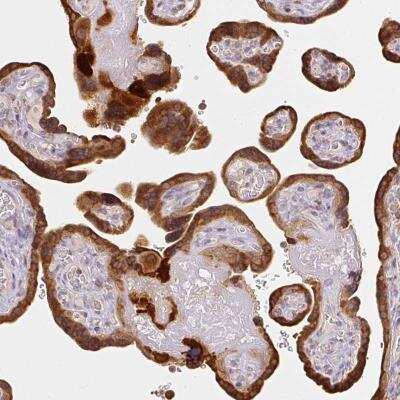 Immunohistochemistry-Paraffin: XAGE2 Antibody [NBP2-46807]