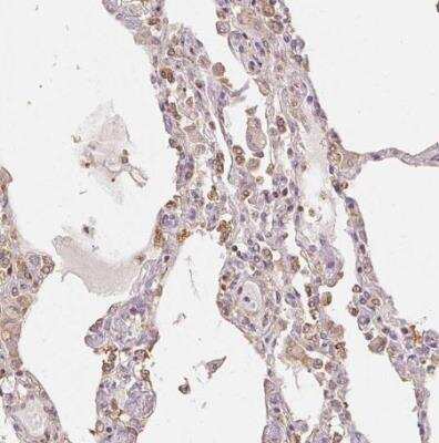 Immunohistochemistry-Paraffin: XAGE2 Antibody [NBP2-46807]