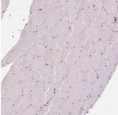 Immunohistochemistry-Paraffin: XAGE2 Antibody [NBP2-46807]