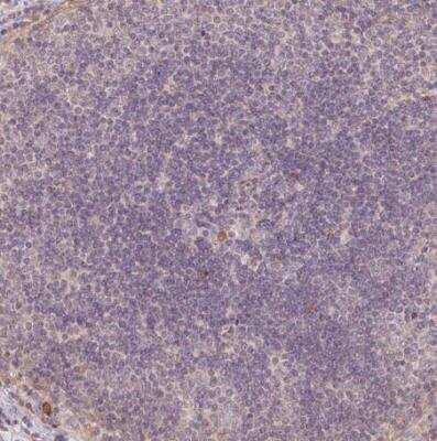 Immunohistochemistry-Paraffin: XAGE2 Antibody [NBP2-46807]