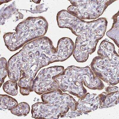 Immunohistochemistry-Paraffin: XAGE2 Antibody [NBP2-46860]