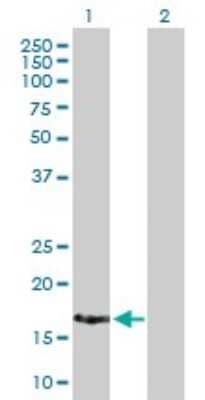 Western Blot: XAGE2 Antibody [H00009502-B01P]