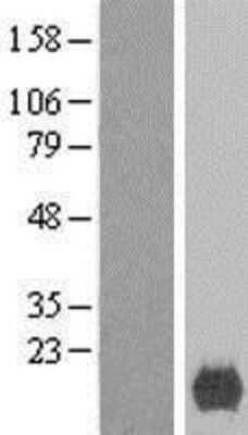 Western Blot: XAGE2 Overexpression Lysate [NBL1-17898]