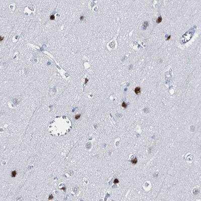 Immunohistochemistry-Paraffin: XAGE3 Antibody [NBP2-31740]