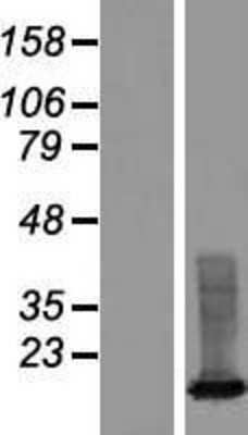 Western Blot: XAGE3 Overexpression Lysate [NBP2-09961]