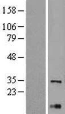 Western Blot: XBP1 Overexpression Lysate [NBL1-17900]