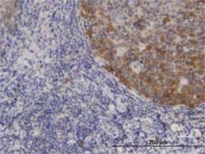 Immunohistochemistry-Paraffin: XCL1/Lymphotactin Antibody (1E1) [H00006375-M01]