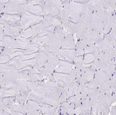 Immunohistochemistry-Paraffin: XCL1/Lymphotactin Antibody [NBP2-46844]