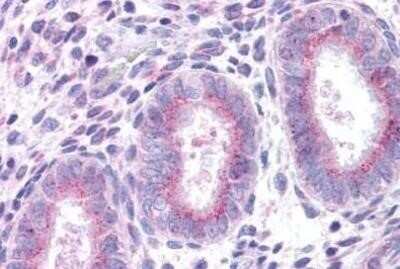 Immunohistochemistry-Paraffin: XCR1/CCXCR1 Antibody - BSA Free [NBP1-02345]