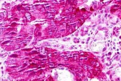 Immunohistochemistry-Paraffin: XCR1/CCXCR1 Antibody - BSA Free [NLS156]