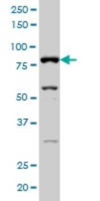 Western Blot: XE7 Antibody (2G8) [H00008227-M02]