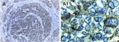 Immunohistochemistry: XIAP Antibody [NB100-56187]