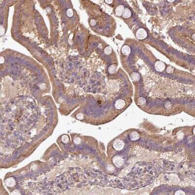 Immunohistochemistry-Paraffin: XIAP Antibody [NBP2-38497]