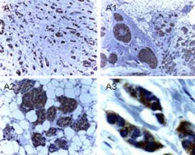 Immunohistochemistry-Paraffin: XIAP Antibody [NB100-56183]