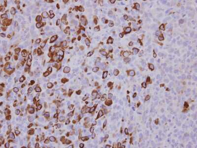 Immunohistochemistry-Paraffin: XIAP Antibody [NBP2-20918]