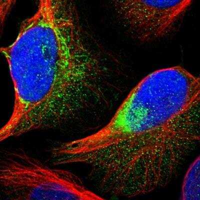 XK X-linked Kx blood group Antibody (NBP1-87828)