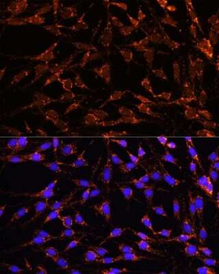 Immunocytochemistry/ Immunofluorescence: XK X-linked Kx blood group Antibody - Azide and BSA Free [NBP2-93011]