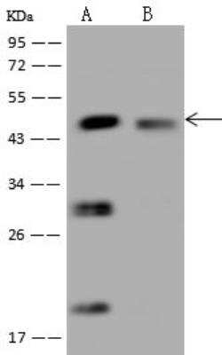 Western Blot: XK X-linked Kx blood group Antibody [NBP3-05963]