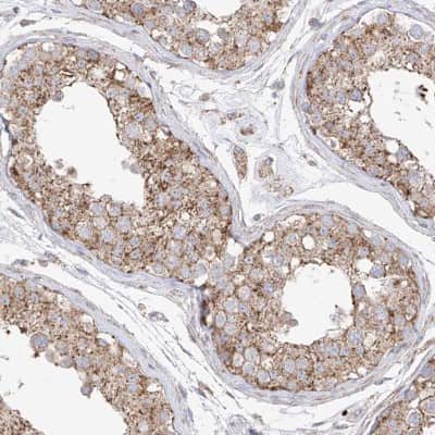 Immunohistochemistry-Paraffin: XKR3 Antibody [NBP2-33987]