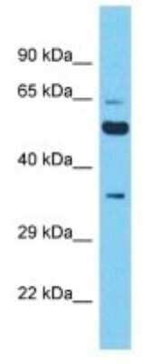 Western Blot: XKR5 Antibody [NBP3-09911]