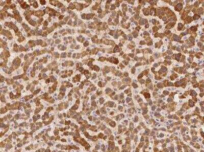 Immunohistochemistry-Paraffin: XKR6 Antibody [NBP3-06015]