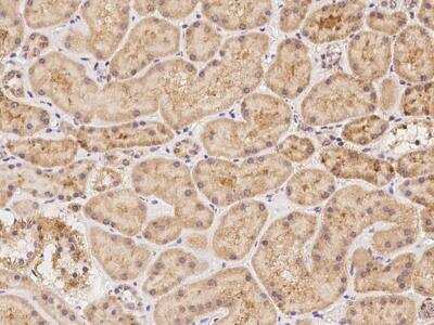 Immunohistochemistry-Paraffin: XKR6 Antibody [NBP3-06015]