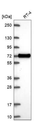 Western Blot: XKR6 Antibody [NBP2-68822]