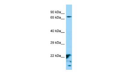 Western Blot: XKR6 Antibody [NBP2-86388]