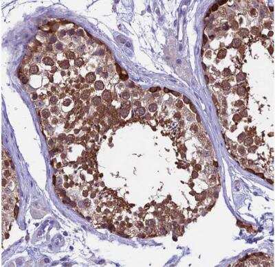 Immunohistochemistry-Paraffin: XKR7 Antibody [NBP1-90697]