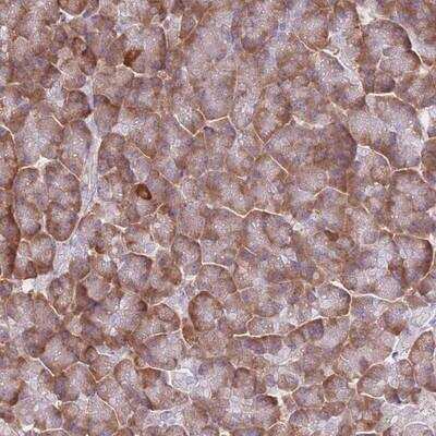 Immunohistochemistry-Paraffin: XKR8 Antibody [NBP2-14699]